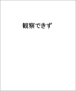 液肥―1週間目の根の生長